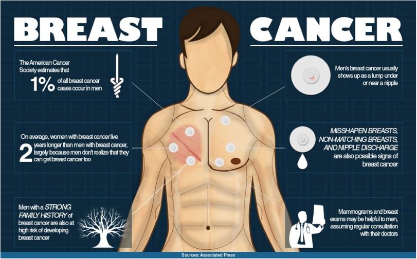 What Is Chest Lump At Sharon Walter Blog